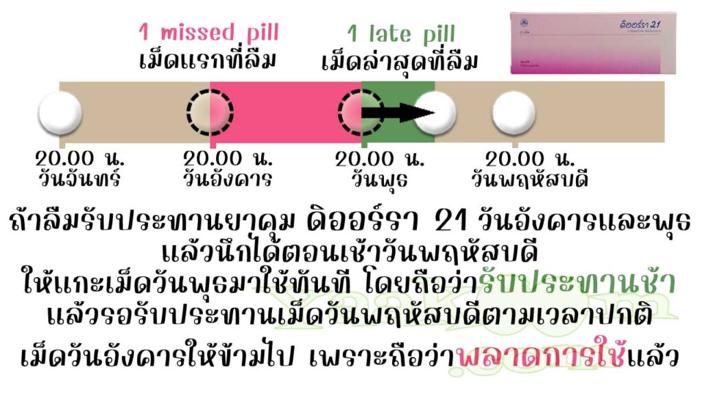 ยกตัวอย่างการแก้ไขเมื่อลืมใช้ ดิออร์รา 21 ติดต่อกัน 2 วัน