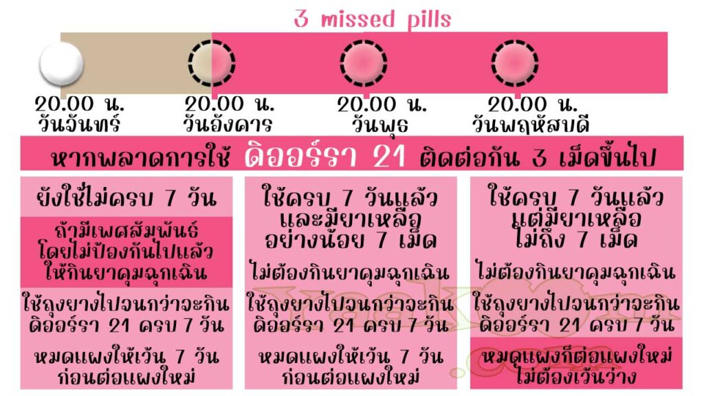 แนวทางแก้ไขเมื่อพลาดการใช้ ดิออร์รา 21 ติดต่อกัน 3 เม็ดขึ้นไป