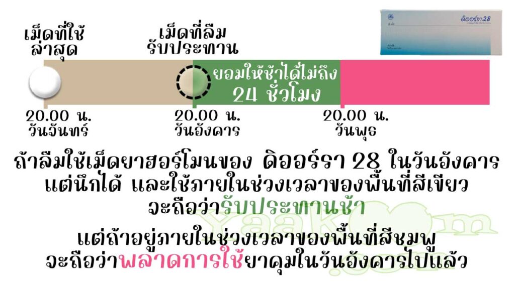 ดิออร์รา 28 ยืดหยุ่นให้รับประทานเม็ดฮอร์โมนช้าได้ไม่ถึง 24 ชั่วโมง ถ้าใช้ไม่ทันจะถือว่าพลาดการใช้