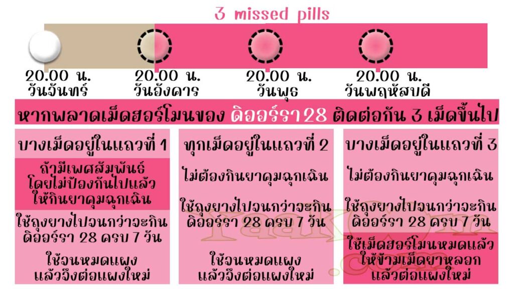 แนวทางแก้ไขเมื่อพลาดการใช้ ดิออร์รา 28 ติดต่อกัน 3 เม็ดขึ้นไป