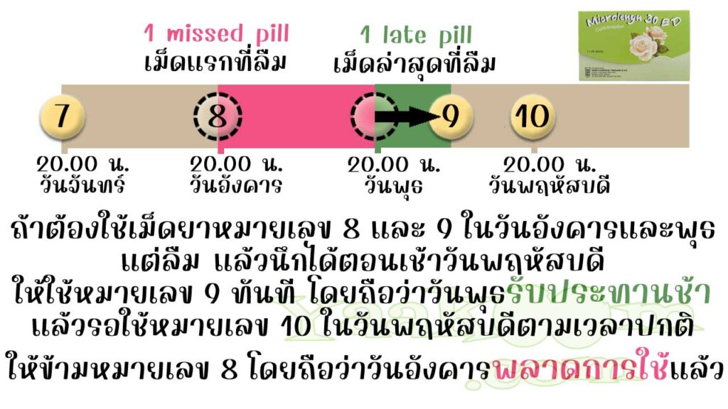 ยกตัวอย่างการแก้ไขเมื่อลืมใช้เม็ดฮอร์โมนของ ไมโครเลนิน 30 ท.ว. ติดต่อกัน 2 วัน