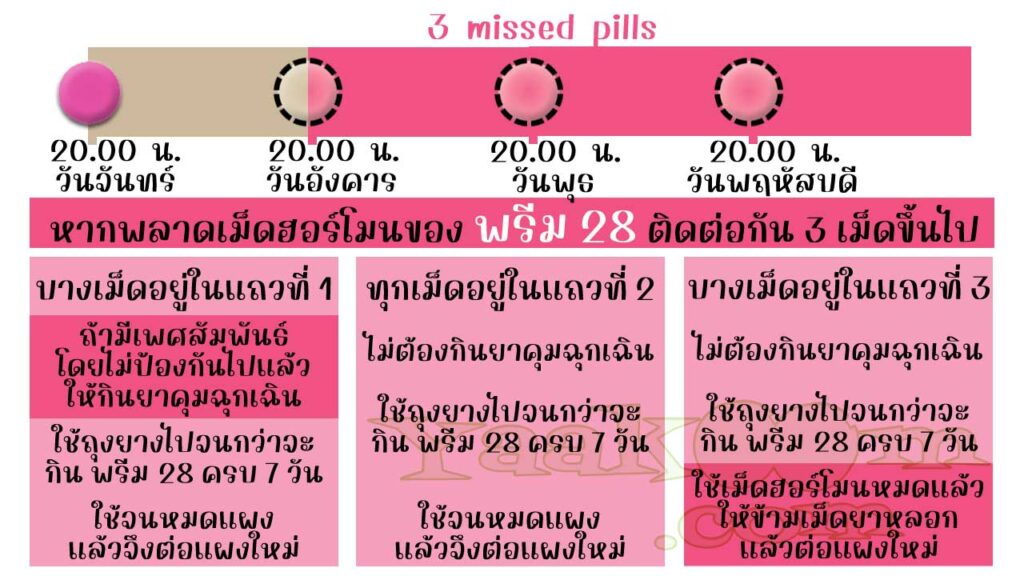 แนวทางแก้ไขเมื่อพลาดการใช้เม็ดฮอร์โมนของ พรีม 28 ติดต่อกัน 3 เม็ดขึ้นไป