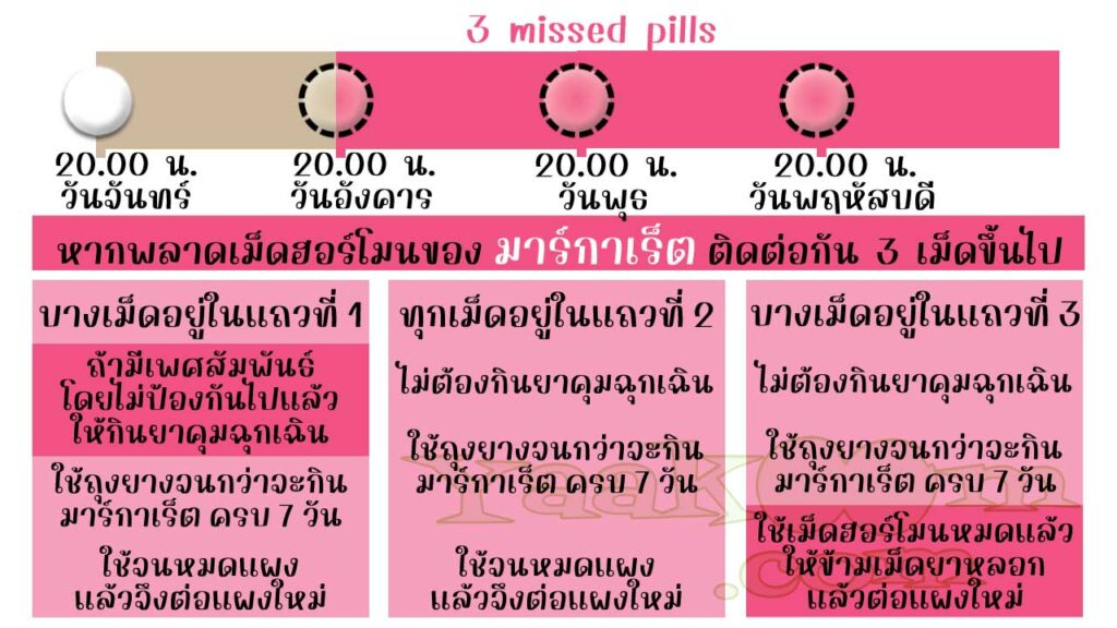 แนวทางแก้ไขเมื่อพลาดการใช้ มาร์กาเร็ต เอ็กซ์โอ ติดต่อกัน 3 เม็ดขึ้นไป