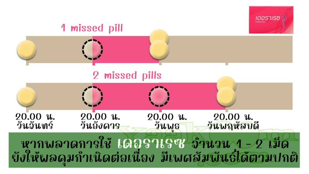 ตามแนวทางขององค์การอนามัยโลก แม้พลาดการใช้ เดอราเรซ จำนวน 1 - 2 เม็ดก็ยังมีผลคุมต่อเนื่อง