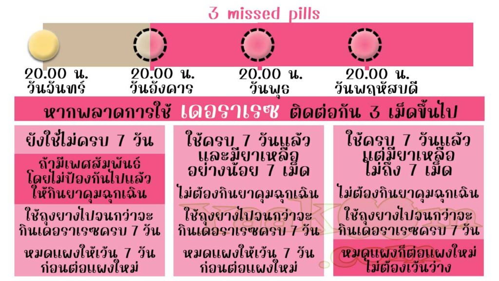แนวทางแก้ไขเมื่อพลาดการใช้ เดอราเรซ ติดต่อกัน 3 เม็ดขึ้นไป