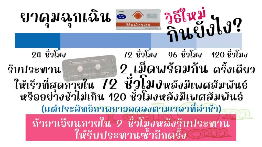 การใช้ยาคุมฉุกเฉิน มาดอนน่า วิธีใหม่ และการแก้ไขเมื่ออาเจียนหลังรับประทาน