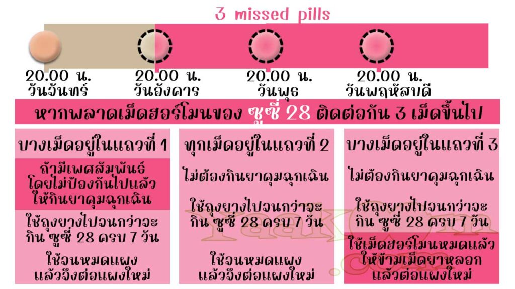 แนวทางแก้ไขเมื่อพลาดการใช้เม็ดฮอร์โมนของ ซูซี่ 28 ติดต่อกัน 3 เม็ดขึ้นไป
