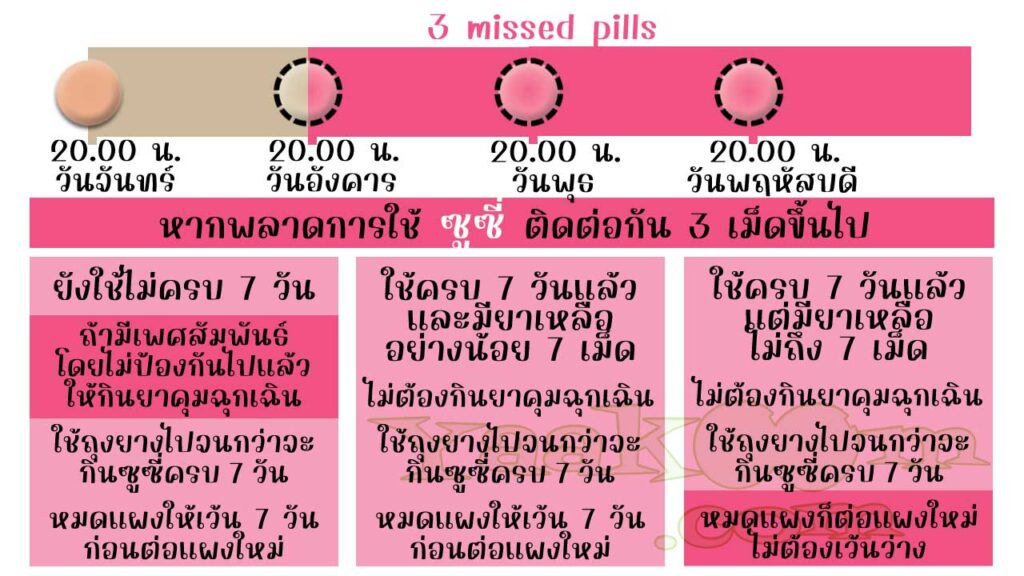 แนวทางแก้ไขเมื่อพลาดการใช้ ซูซี่ ติดต่อกัน 3 เม็ดขึ้นไป